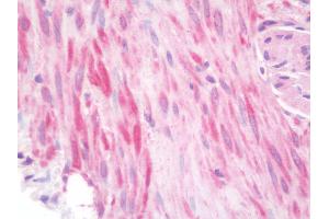 anti-F-Box and WD Repeat Domain Containing 4 (FBXW4) (AA 5-186) antibody