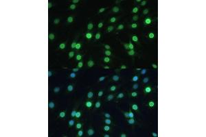 Immunofluorescence analysis of C6 cells using LBR Polyclonal Antibody (ABIN6128194, ABIN6143105, ABIN6143106 and ABIN6221130) at dilution of 1:100 (40x lens). (Lamin B Receptor 抗体  (AA 1-211))