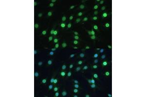 Immunofluorescence analysis of C6 cells using LBR Polyclonal Antibody (ABIN6128194, ABIN6143105, ABIN6143106 and ABIN6221130) at dilution of 1:100 (40x lens). (Lamin B Receptor 抗体  (AA 1-211))