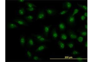Immunofluorescence (IF) image for anti-SMAD, Mothers Against DPP Homolog 1 (SMAD1) (AA 1-465) antibody (ABIN517611)