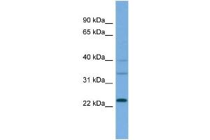 WB Suggested Anti-RALA  Antibody Titration: 0. (rala 抗体  (Middle Region))