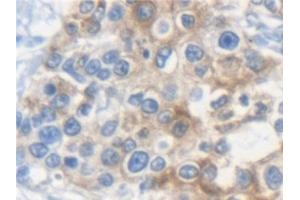 Immunohistochemistry (IHC) image for anti-Keratin 33A (KRT33A) (AA 57-363) antibody (ABIN7441730)