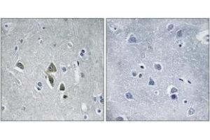 Immunohistochemistry (IHC) image for anti-Ornithine Decarboxylase Antizyme 1 (OAZ1) (AA 14-63) antibody (ABIN2890479)