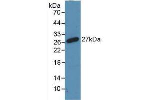 Western blot analysis of recombinant Rat RANk. (TNFRSF11A 抗体  (AA 31-214))