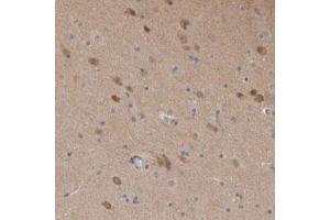 Immunohistochemical staining (Formalin-fixed paraffin-embedded sections) of human cerebral cortex with SCRN1 polyclonal antibody  shows moderate cytoplasmic positivity in neuronal cells. (Secernin 1 抗体)