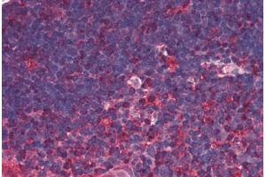 Human Thymus (formalin-fixed, paraffin-embedded) stained with TRDMT1 antibody ABIN290198 at 5 ug/ml followed by biotinylated anti-mouse IgG secondary antibody ABIN481714, alkaline phosphatase-streptavidin and chromogen. (Dnmt2 抗体)