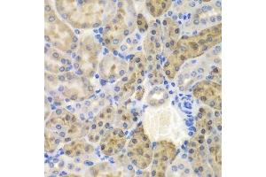 Immunohistochemistry of paraffin-embedded mouse kidney using AKR1A1 antibody.