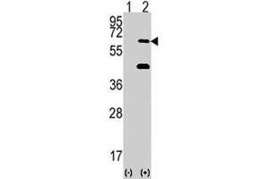 Western blot analysis of EIF2AK2 (arrow) using EIF2AK2 polyclonal antibody . (EIF2AK2 抗体  (N-Term))