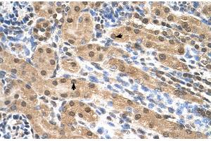 Human kidney (Eukaryotic Translation Initiation Factor 3, Subunit M (EIF3M) (N-Term) 抗体)