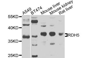 Western blot analysis of extracts of various cells, using RDH5 antibody. (RDH5 抗体)