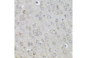 Immunohistochemistry of paraffin-embedded mouse brain using IL13 antibody (ABIN5971115) (40x lens). (IL-13 抗体)