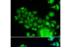 Immunofluorescence analysis of HeLa cells using FZR1 Polyclonal Antibody (FZR1 抗体)