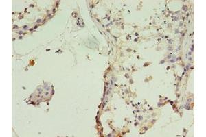Immunohistochemistry of paraffin-embedded human testis tissue using ABIN7159886 at dilution of 1:100 (TIMM1B (AA 1-103) 抗体)