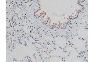 ABIN6267398 at 1/200 staining Rat lung tissue sections by IHC-P. (H2AFX 抗体  (pSer139))