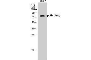 Western Blotting (WB) image for anti-V-Akt Murine Thymoma Viral Oncogene Homolog 1 (AKT1) (pSer473) antibody (ABIN6288035)