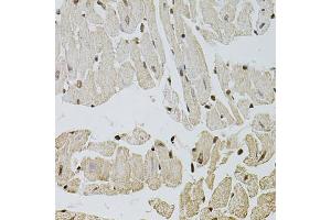 Immunohistochemistry of paraffin-embedded mouse heart using FGF2 antibody (ABIN1872685) at dilution of 1:100 (40x lens). (FGF2 抗体)