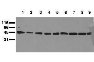 Western Blotting (WB) image for anti-Mitogen-Activated Protein Kinase Kinase 1 (MAP2K1) antibody (ABIN126837) (MEK1 抗体)