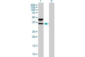 Lane 1: FUT6 transfected lysate ( 41. (FUT6 293T Cell Transient Overexpression Lysate(Denatured))