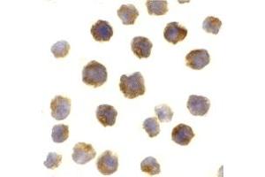 Immunohistochemistry (IHC) image for anti-B-Cell CLL/lymphoma 2 (BCL2) (Middle Region) antibody (ABIN1030884) (Bcl-2 抗体  (Middle Region))