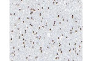 Immunohistochemistry (IHC) image for anti-E2F Transcription Factor 6 (E2F6) (Internal Region) antibody (ABIN6261413)