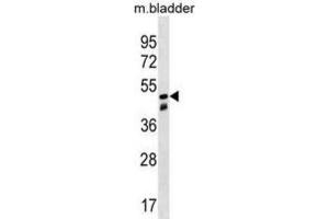 Western Blotting (WB) image for anti-Sorting Nexin 8 (SNX8) antibody (ABIN3000289) (SNX8 抗体)