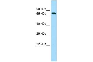 WB Suggested Anti-C20orf112 Antibody Titration: 1. (C20orf112 抗体  (N-Term))