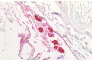 Detection of LIPB in Human Breast Tissue using Polyclonal Antibody to Lipophilin B, Prostatein Like (LIPB) (Lipophilin B 抗体  (AA 22-90))