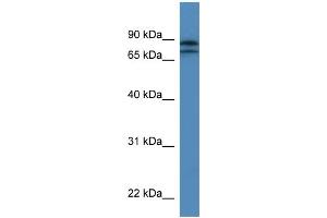 WB Suggested Anti-KLHL22 Antibody Titration: 0. (KLHL22 抗体  (N-Term))