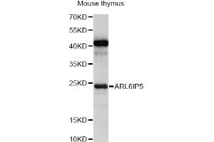 Western blot analysis of extracts of mouse thymus, using ARL6IP5 antibody (ABIN6292619) at 1:1000 dilution. (ARL6IP5 抗体)