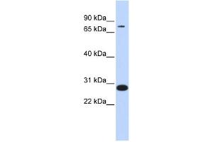 WB Suggested Anti-TCF12 Antibody Titration:  0. (TCF12 抗体  (Middle Region))