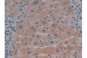 IHC-P analysis of Human Liver Tissue, with DAB staining. (CXCL12 抗体  (AA 23-89))