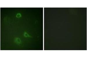 Immunofluorescence analysis of A549 cells, using NMDAR1 (Phospho-Ser890) Antibody. (GRIN1/NMDAR1 抗体  (pSer890))
