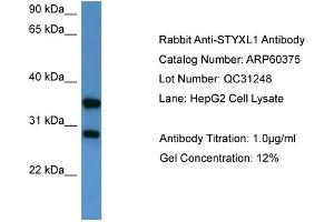 WB Suggested Anti-STYXL1  Antibody Titration: 0. (STYXL1 抗体  (Middle Region))
