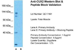 Host:  Rabbit  Target Name:  CUX2  Sample Type:  Fetal Muscle  Lane A:  Primary Antibody  Lane B:  Primary Antibody + Blocking Peptide  Primary Antibody Concentration:  1ug/ml  Peptide Concentration:  5ug/ml  Lysate Quantity:  25ug/lane/Lane  Gel Concentration:  0. (CUX2 抗体  (N-Term))