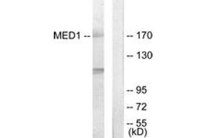 Western blot analysis of extracts from Jurkat cells, using MED1 Antibody.