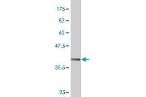 Western Blot detection against Immunogen (37. (HHEX 抗体  (AA 133-237))