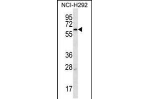 Western blot analysis in NCI-H292 cell line lysates (35ug/lane). (MBTPS2 抗体  (N-Term))