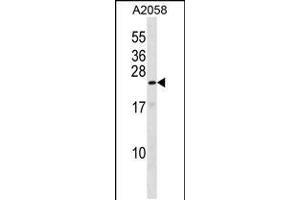 Western blot analysis in A2058 cell line lysates (35ug/lane). (KRAB Box Domain Containing 4 (KRBOX4) (AA 96-125), (C-Term) 抗体)