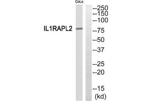 Western Blotting (WB) image for anti-Interleukin 1 Receptor Accessory Protein-Like 2 (IL1RAPL2) (Internal Region) antibody (ABIN1852772) (IL1RAPL2 抗体  (Internal Region))