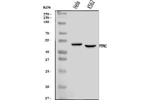 Western blot analysis of TCPTP/PTPN2 using anti-TCPTP/PTPN2 antibody (ABIN7599167).