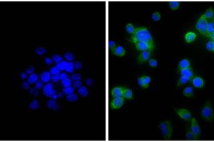 Human pancreatic carcinoma cell line MIA PaCa-2 was stained with Mouse Anti-Cytokeratin 18-UNLB, and DAPI.