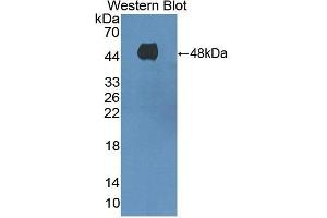 Detection of Recombinant ADCY8, Human using Polyclonal Antibody to Adenylate Cyclase 8, Brain (ADCY8) (ADCY8 抗体  (AA 234-371))