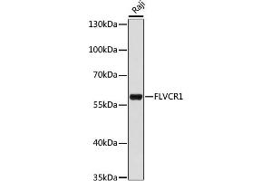 Western blot analysis of extracts of Raji cells, using FLVCR1 antibody (ABIN7267164) at 1:1000 dilution. (FLVCR 抗体  (AA 250-350))
