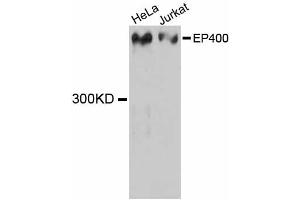 Western blot analysis of extracts of various cell lines, using EP400 antibody (ABIN5997682) at 1:3000 dilution. (EP400 抗体)