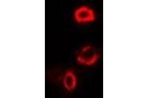 Immunofluorescent analysis of OGDH staining in U2OS cells. (alpha KGDHC 抗体)