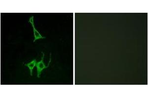 Immunofluorescence analysis of LOVO cells, using NMUR1 Antibody. (NMUR1 抗体  (AA 1-50))