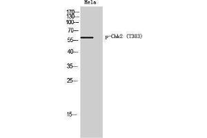 Western Blotting (WB) image for anti-Checkpoint Kinase 2 (CHEK2) (pThr383) antibody (ABIN3179592) (CHEK2 抗体  (pThr383))