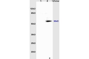 L1 rat heart lysates, L2 rat brain lysates probed: Anti-Tubulin-alpha (ABIN725630) at 1:200 in 4 °C. (alpha Tubulin 抗体  (AA 375-448))