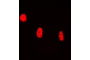Immunofluorescent analysis of BRAF35 staining in HEK293T cells. (HMG20B 抗体  (N-Term))