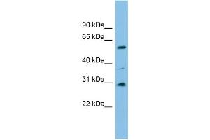 WB Suggested Anti-DUS1L Antibody Titration: 0. (DUS1L 抗体  (Middle Region))